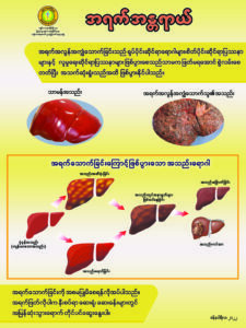 အရက်အန္တရာယ်
